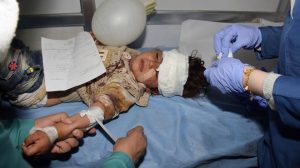 Verletztes Kind des Anschlags in Aleppo, Photo: SANA