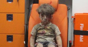 ʽUmrân aus Aleppo: das Bild ging um die Welt, Photo: Sputnik